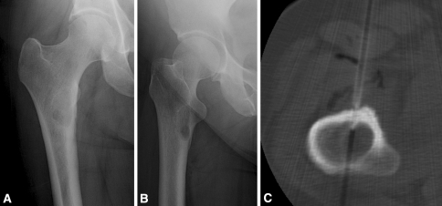 Fig. 1A–C