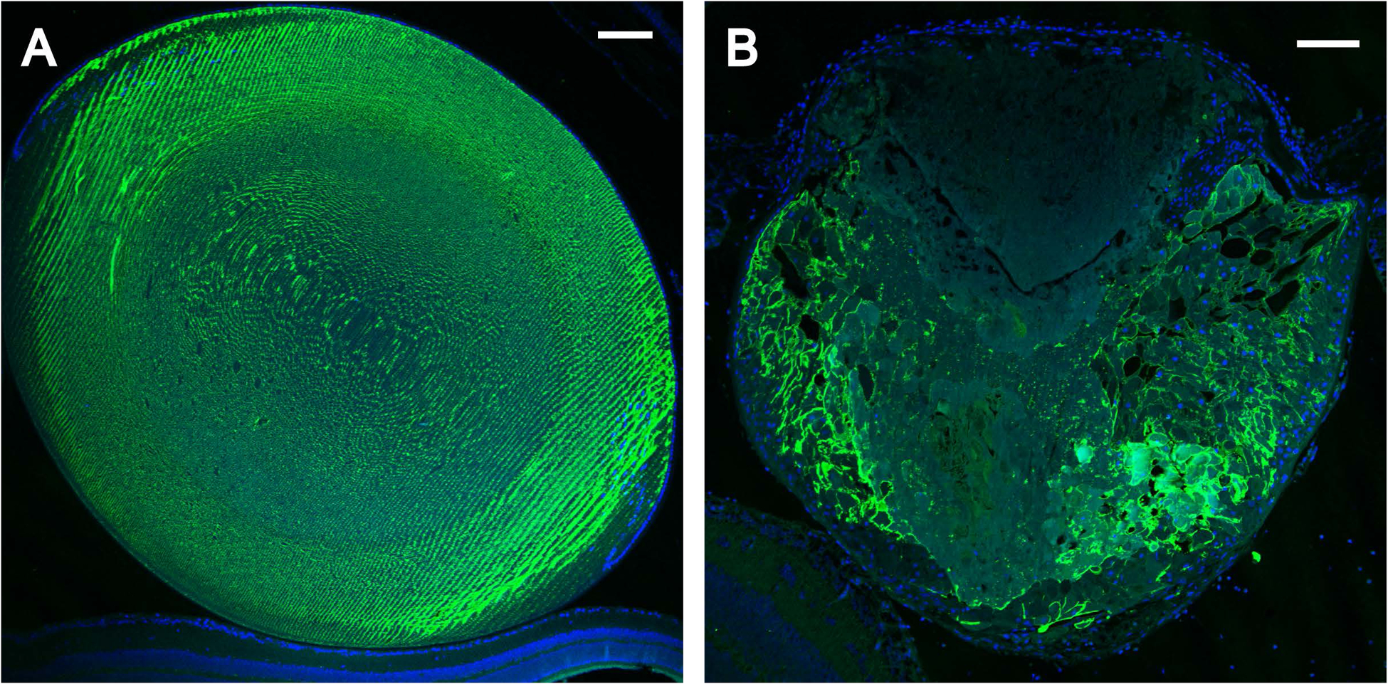 Figure 11.