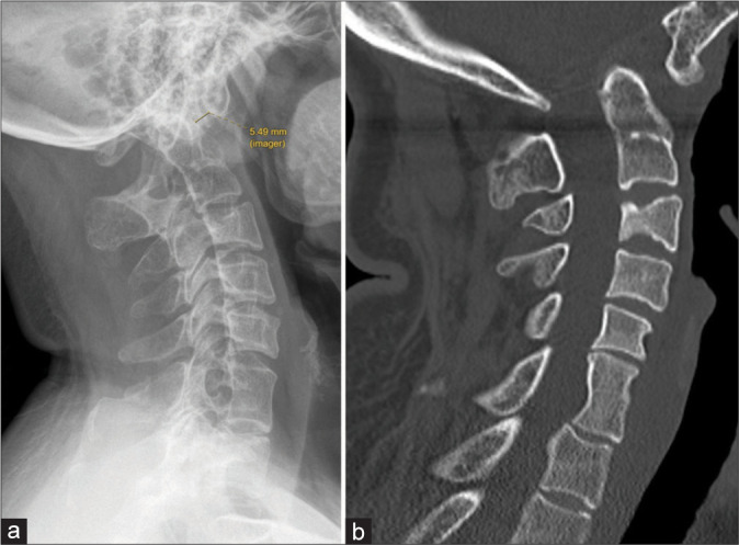 Figure 6: