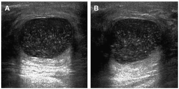 Fig. 26