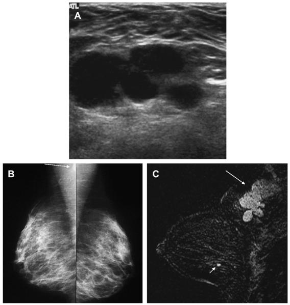 Fig. 19