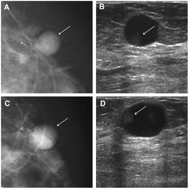 Fig. 65