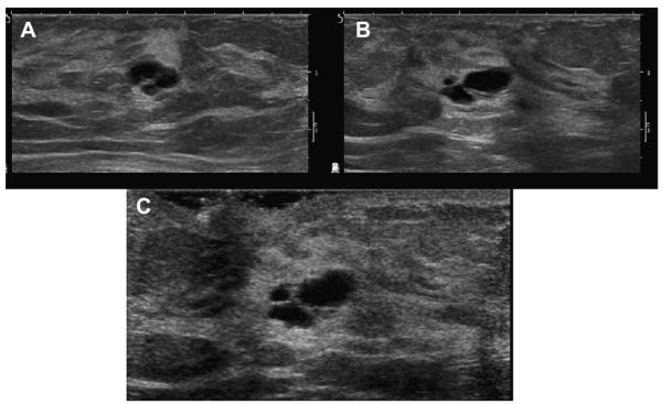 Fig. 12