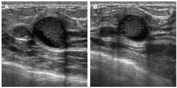 Fig. 29