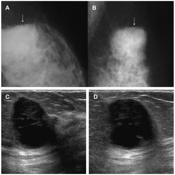 Fig. 55