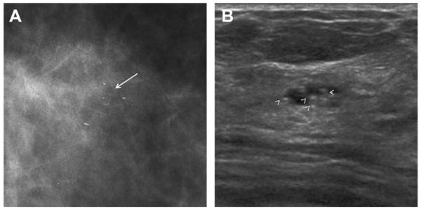 Fig. 48