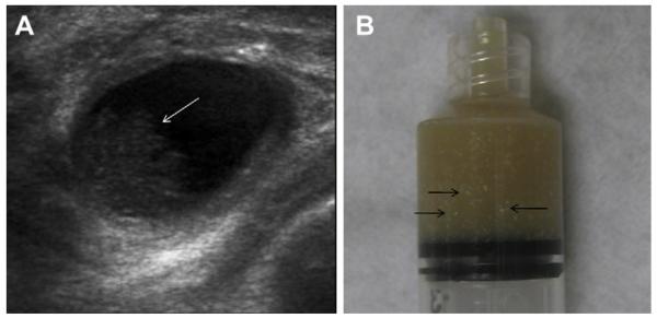 Fig. 62