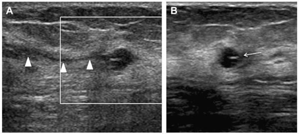 Fig. 13