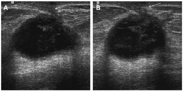 Fig. 57