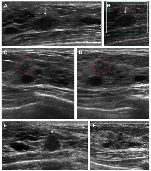 Fig. 23