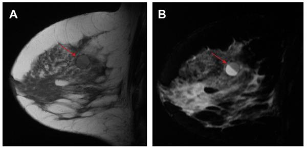 Fig. 34