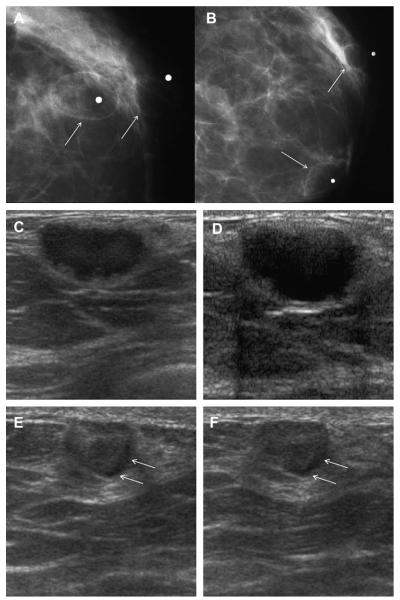 Fig. 41