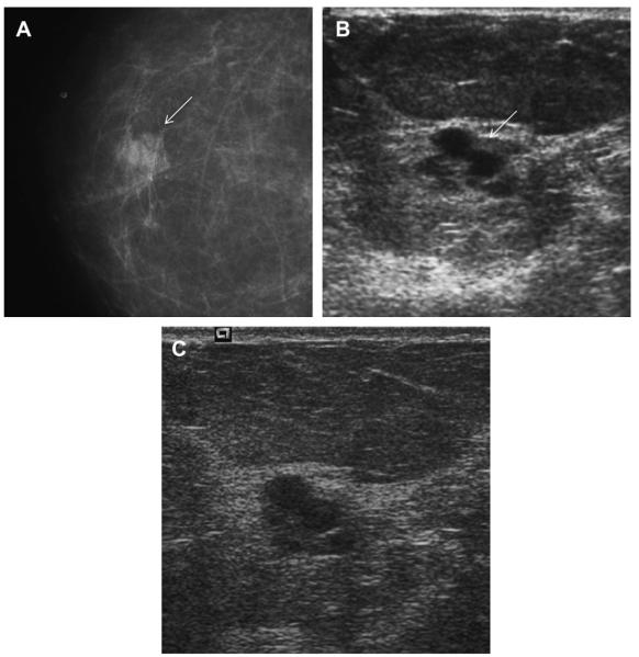 Fig. 52