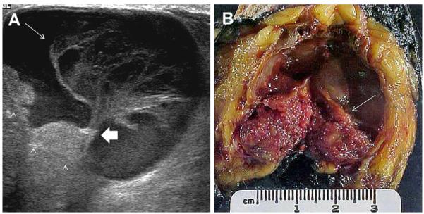 Fig. 64