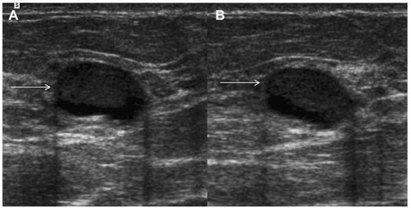 Fig. 37