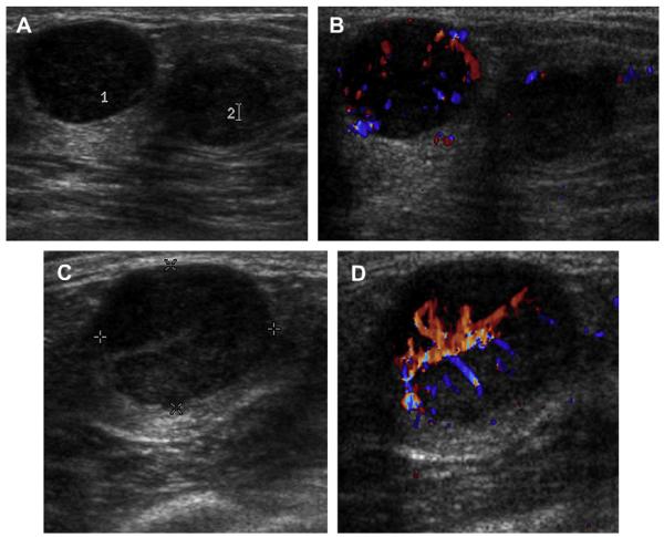 Fig. 38