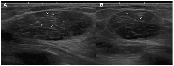 Fig. 35