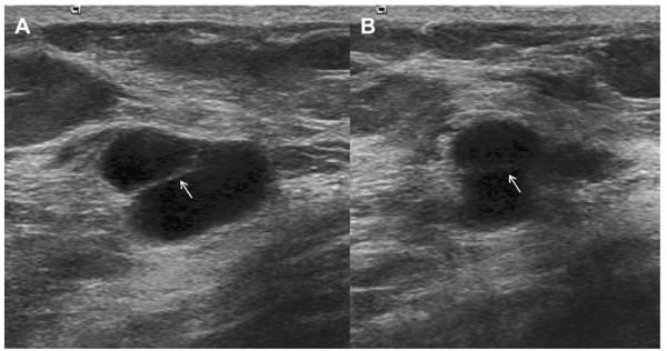 Fig. 11