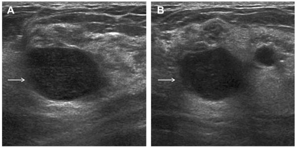 Fig. 22