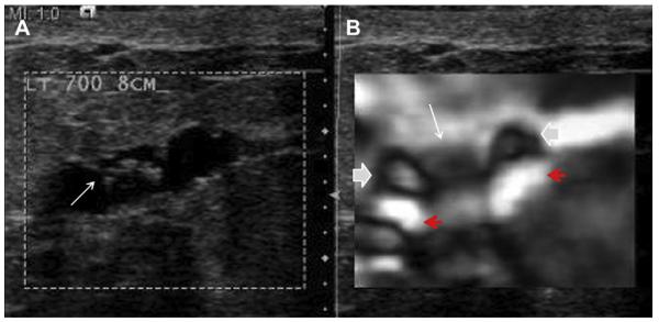 Fig. 17