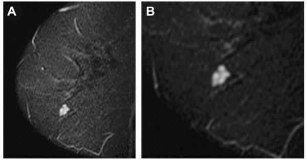 Fig. 50