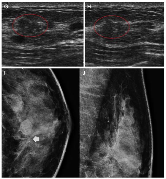 Fig. 23