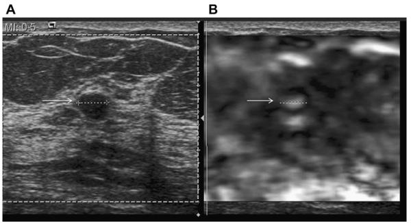 Fig. 31