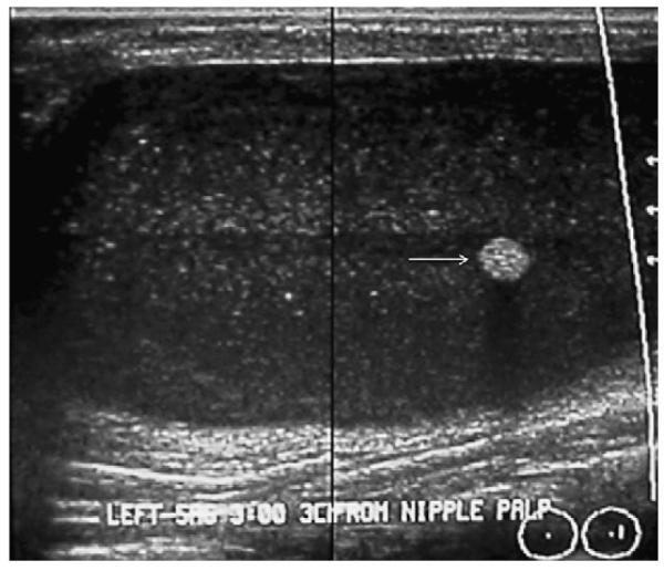 Fig. 36