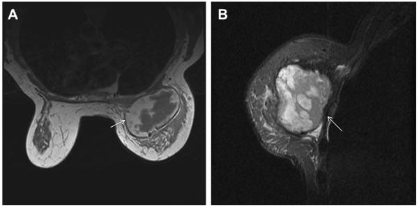 Fig. 60