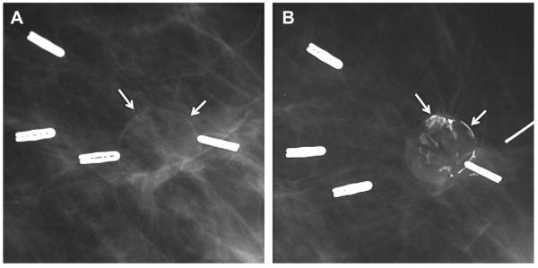 Fig. 40