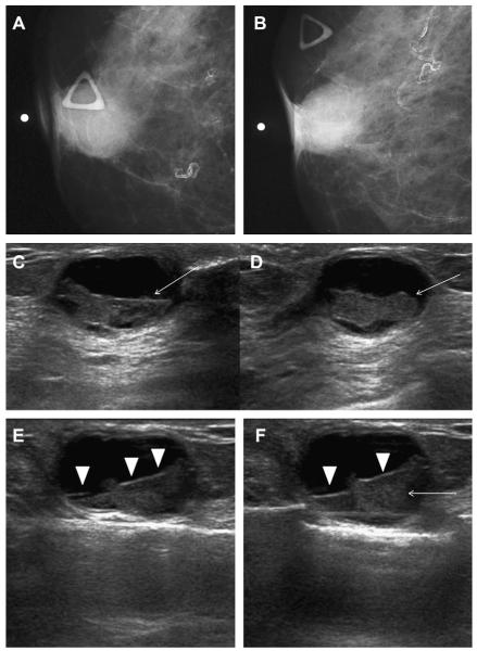 Fig. 27