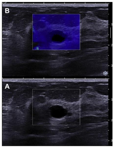 Fig. 18