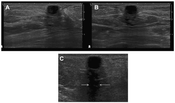 Fig. 42