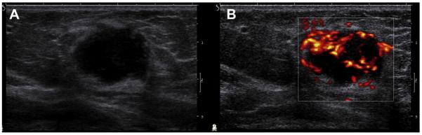 Fig. 21