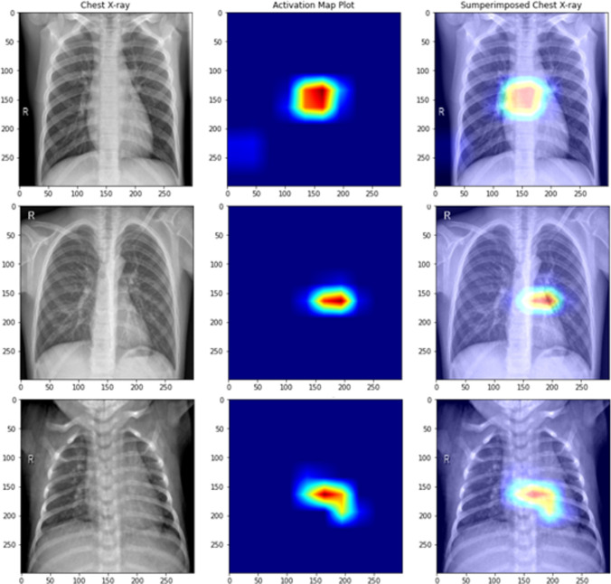 Fig. 12