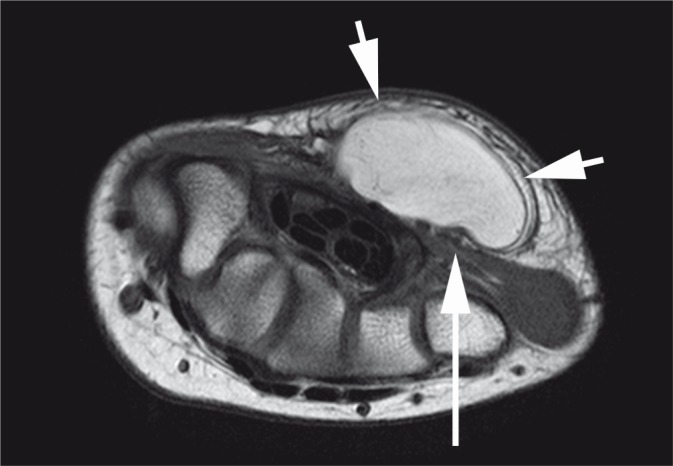 Fig. 12