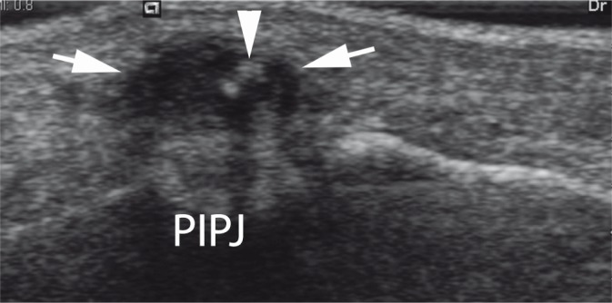 Fig. 31