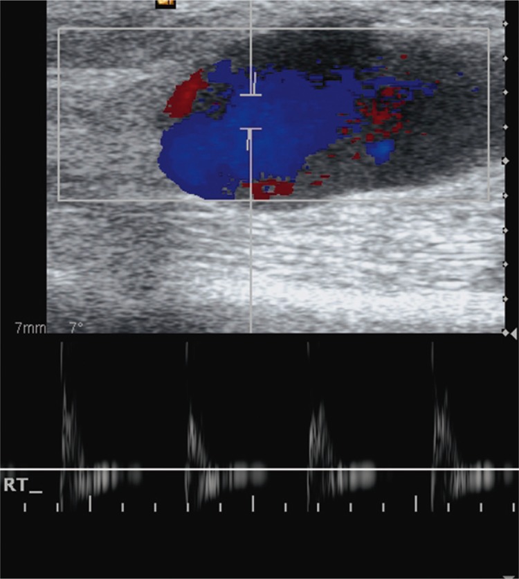 Fig. 20