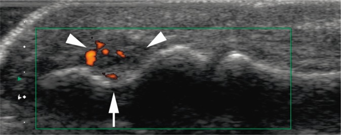 Fig. 24