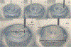 Fig. 14