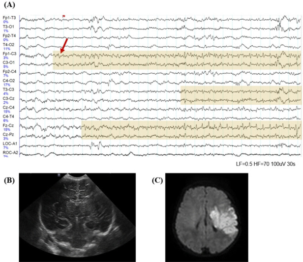 Fig. 3.