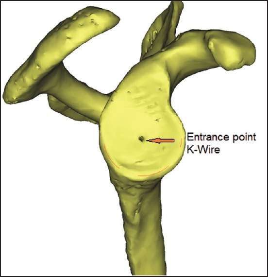 Figure 10