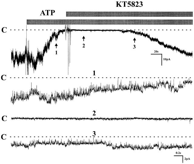 Figure 11