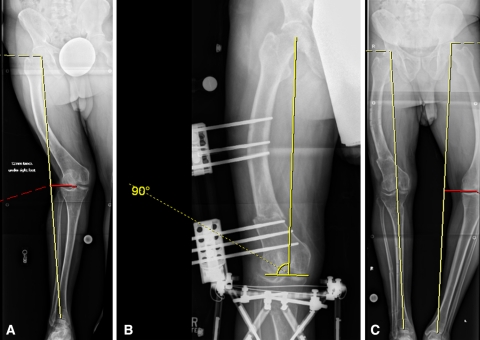 Fig. 1A–C