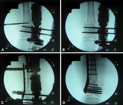 Fig. 2A–D