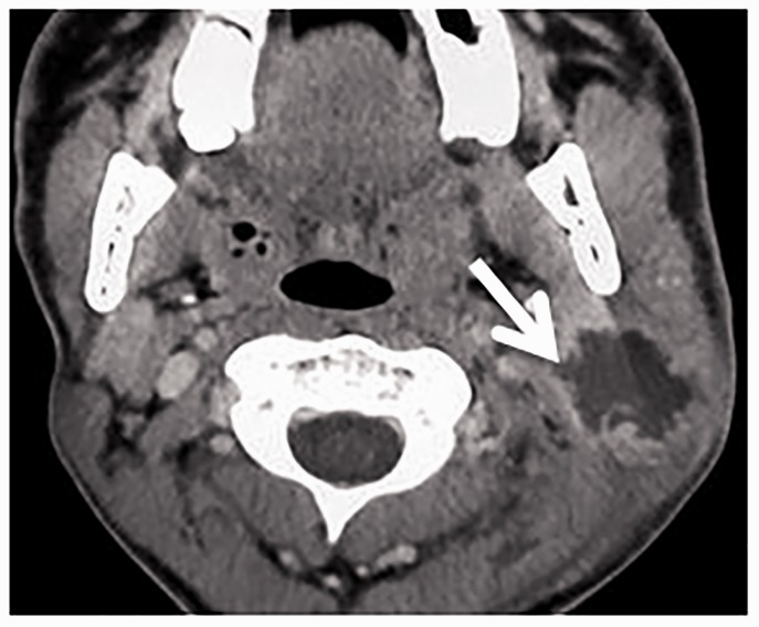 Figure 10.