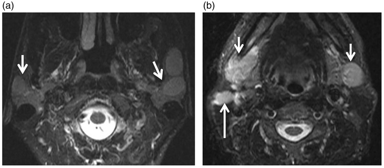 Figure 11.