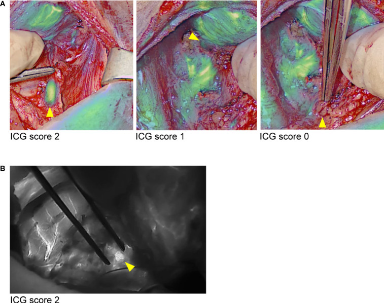 Figure 3