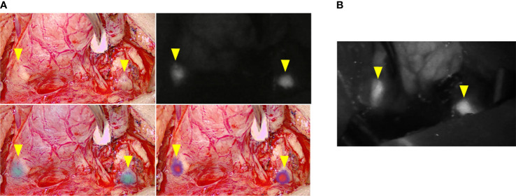 Figure 2