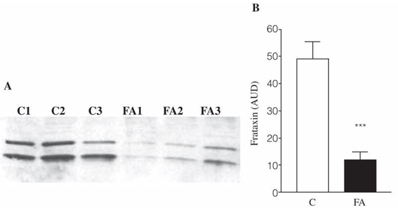 FIG. 1